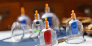 hacamat-nasil-yapilir