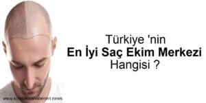 Saç Ekimi Türkiye En İyi Saç Ekim Merkezi Tavsiye TOP 10 Listesi