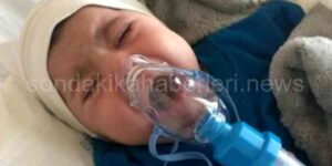 Erzurum’un İlk SMA TİP-1 Hastası: Muhammed Eymen Bebek