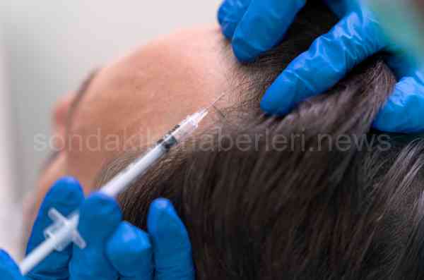 Gold City Hair Transplant İstanbul Turkey