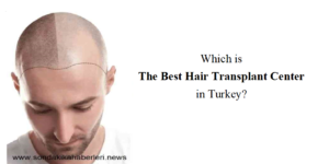 Turkey's Best Hair Transplantation Centers