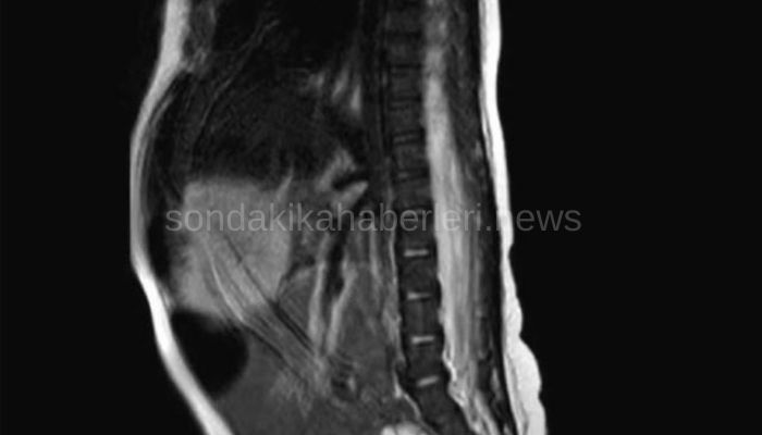 Bebekte Başka Bir Rahatsızlık Görülmedi