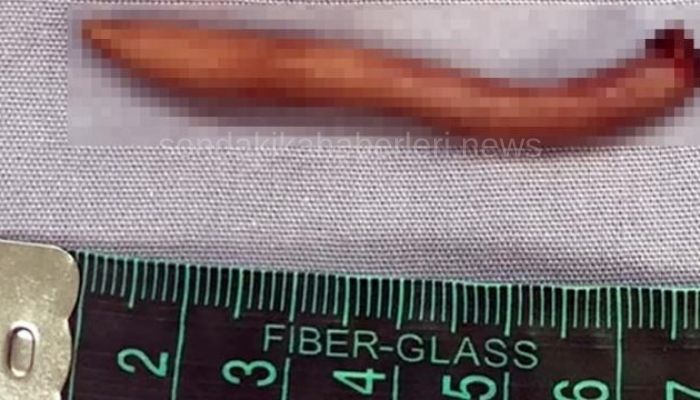 dr-josue-rueda-kuyruk-bes-yedi-santim-uzunlugunda