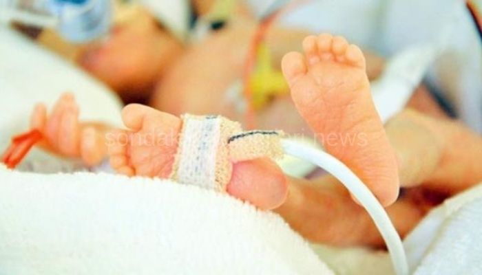 En Büyük Kuyruğun 20 Cm Olduğu Belirtildi