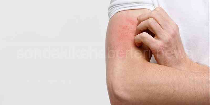 Dermapen Yaptırmak Zararlı Mı?