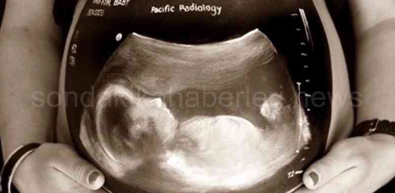 Hamileyken Röntgen Tetkiki Yaptırılabilir Mi?
