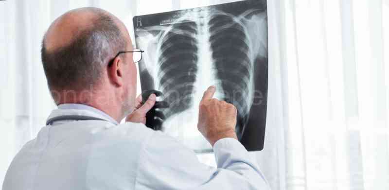 Röntgen Tesisinin Prosedürü Gerçekleştirmek İçin Güvenli Olup Olmadığını Nasıl Bilebilirim?