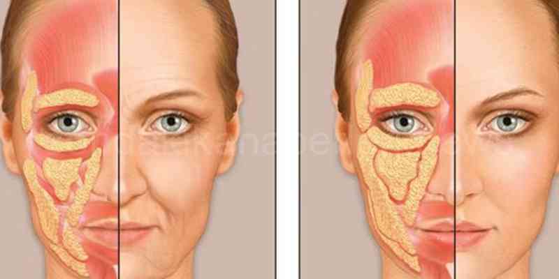 Endopeel Zararları Endopeel Nedir 3 Uygulama Alanı? 10 Endopeel Etkisi Ne Zaman Başlar