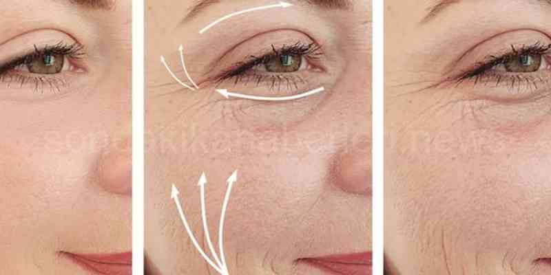 Endopeel Zararları Endopeel Nedir 3 Uygulama Alanı? 2 Endopeel Nedir Zararları