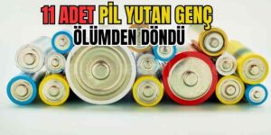 Çin'de Bir Genç 11 Adet Kalem Pil Yuttu